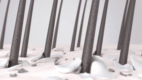 3D-rendered animation shows white dead-skin flakes, dirt particles, and sebum build-up around the hair follicles on the scalp. Dandruff, seborrheic dermatitis, scalp psoriasis, or fungus skin disease  - Powered by Shutterstock - Get 15% off with code: PIKWIZARD15