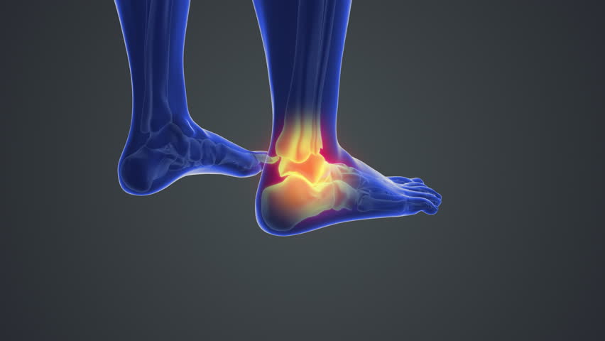 Medical animation with Feet joint pain