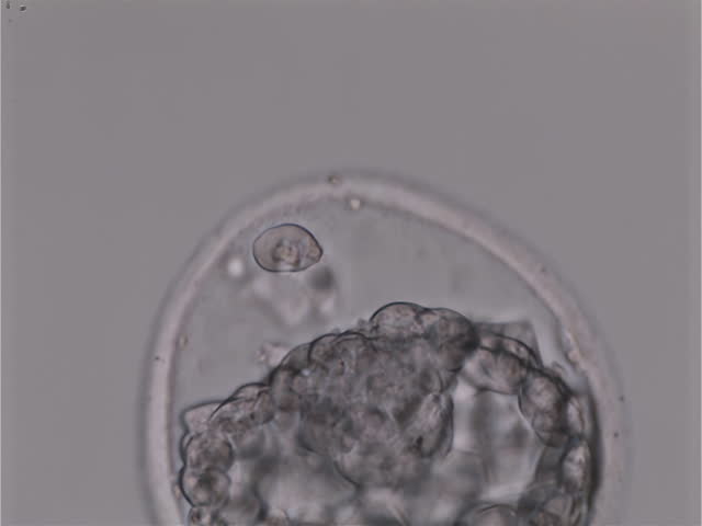 Embryo breaking out of outer layer in the female egg for the ivf embryo hatching process. Performing the ivf embryo hatching on patient. Assisted ivf embryo hatching procedure for women health | Shutterstock HD Video #1111804533