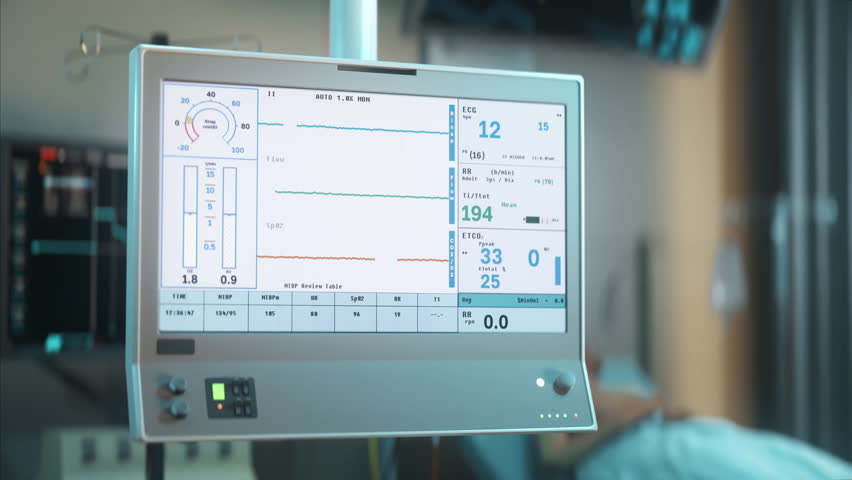 Medical Device For Lung Health Test Detects Decline In Vital Parameters. Medical Artificial Lung Ventilation Test. Dying Patient At Hospital. Medical Monitoring Lung Test. Clinic Equipment | Shutterstock HD Video #1111804537