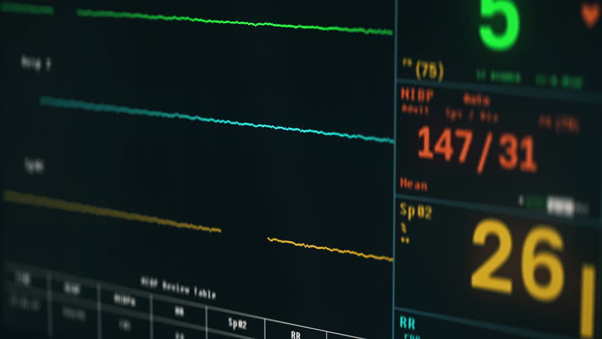 Healthcare Monitoring Equipment Alerts Doctors Of Patient's Decreasing Heartbeat. Death Recorded By Healthcare Hospital Monitoring Equipment. Healthcare Monitoring System Shows Falling Vital Signs | Shutterstock HD Video #1111804545
