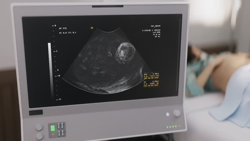 Prenatal Examination Device Analyzes Fetus In Childbirth Clinic. Prenatal Examination Device Scans Child Of Pregnant Woman. Prenatal Examination Test. Medical Device. Birth. Newborn | Shutterstock HD Video #1111804549