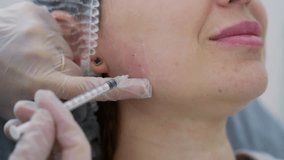 Beautician doctor makes botox injection in the cheekbone of young beautiful woman. Extreme close up 4k shot - Powered by Shutterstock - Get 15% off with code: PIKWIZARD15
