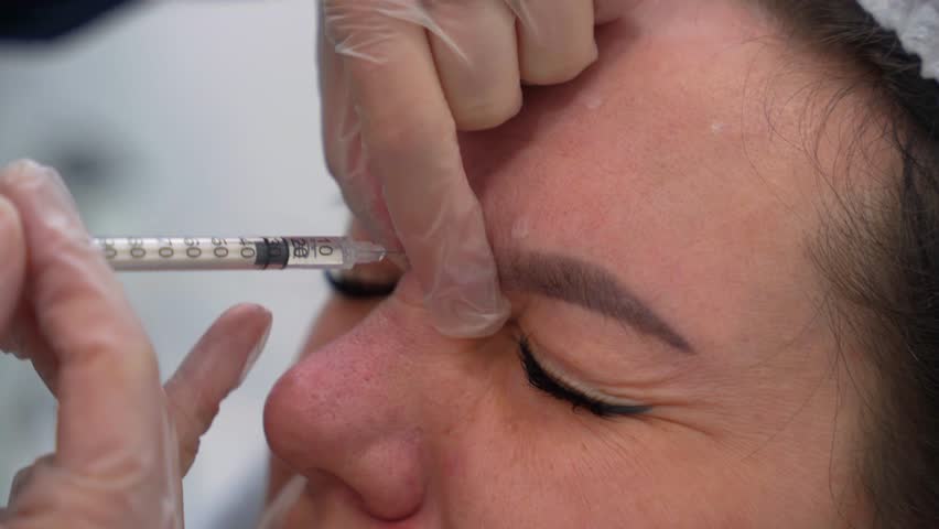 Beautician doctor makes botox injection in the forehead of young beautiful woman. Extreme close up 4k shot
