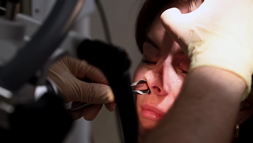 Beautiful Young Woman Having nose Examination in clinic , otolaryngologist inspects nose. 4k cinematic slow motion video | Shutterstock HD Video #1111860063
