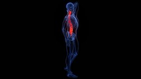 Pain in Spinal Cord Vertebral Column of Human Skeleton System Anatomy Animation Concept. 3D