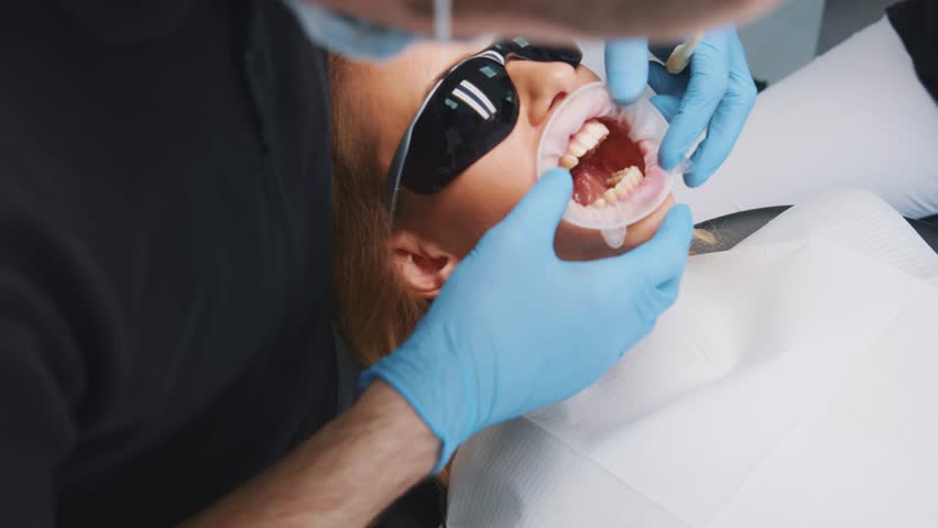 Close-up of dentist inserting dental cap into customer's mouth for treatment. Young woman wearing dental black glasses visiting orthodontist in hospital. | Shutterstock HD Video #1112014931