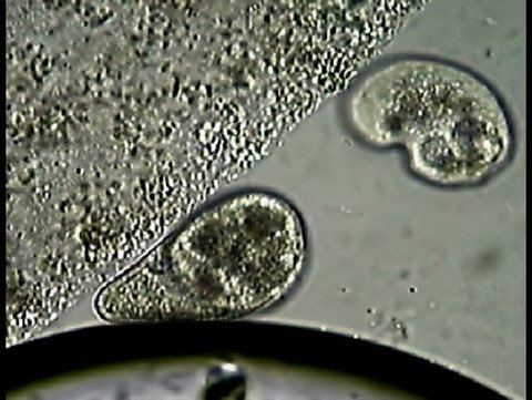  The ciliate Colpoda demonstrating its characteristic motion.  Magnification 200X