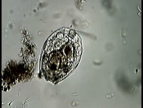 A Monostyla rotifer with highly magnified views of feeding cilia and flexible foot joint 