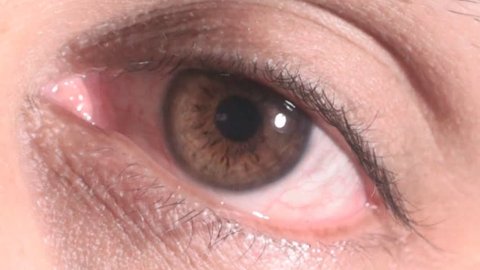 Close-up of a tired red eye