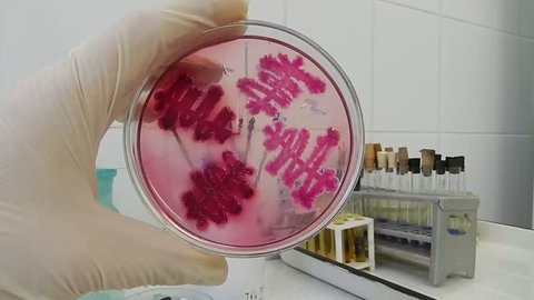 Scientist analyzing infection in a petri dish in the microbiological laboratory