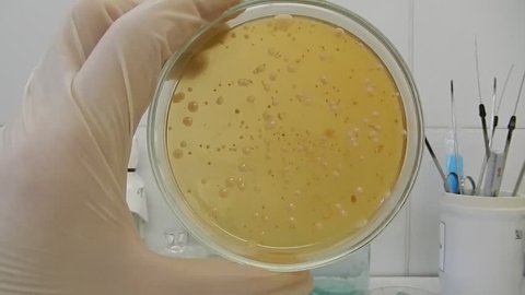Scientist analyzing infection in a petri dish in the microbiological laboratory