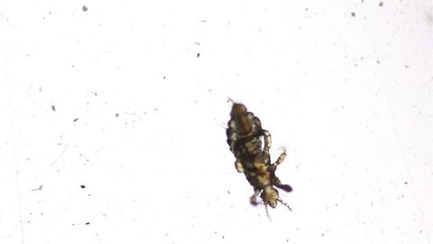 Macro shot of Head lice (louse) on white background
