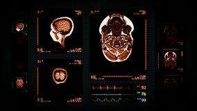 Brain MRI Scan. Amber. 4 videos in 1 file. Animation showing top, front, lateral view and ECG display. Each video is loopable. Medical Background. More options in my portfolio.