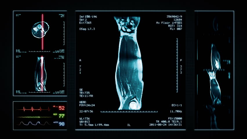 WRIST-MRI Footage, Videos and Clips in HD and 4K - Avopix.com