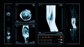 Knee MRI Scan. Blue. 4 videos in 1 file. Animation showing top, front, lateral view and ECG display. Each video is loopable. Medical Background. More options in my portfolio.