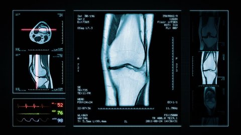 Knee MRI Scan. Blue. 4 videos in 1 file. Animation showing top, front, lateral view and ECG display. Each video is loopable. Medical Background. More options in my portfolio.