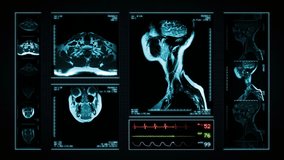 Neck MRI Scan. Blue. 3 videos in 1 file. Animation showing top, front, lateral view and ECG display. Each video is loopable. Medical Background. More options in my portfolio.