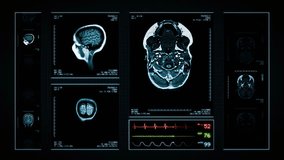 Brain MRI Scan. Blue. 3 videos in 1 file. Animation showing top, front, lateral view and ECG display. Each video is loopable. Medical Background. More options in my portfolio.