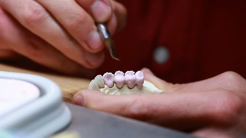 Dental implants laboratory sequence  Stock Video