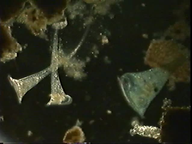 Microscopic-educational: A rare view of two Stentor protozoan species, Stentor roeselii on the left and the beautiful Blue Stentor, Stentor coeruleus on the right.  Also, note the Rotifer lower right.