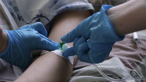 Nurse putting a drip into the catheter lying patients close-up