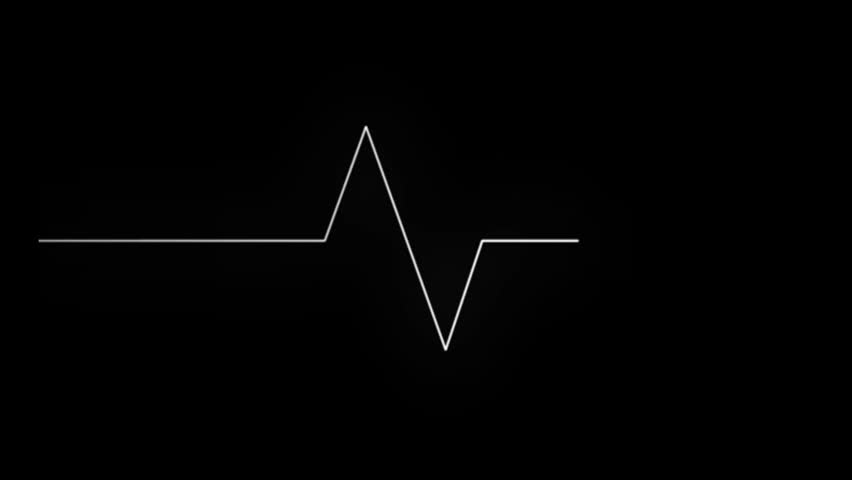 Ekg Life Line On Black Screen Stock Footage Video 100 Royalty Free 12361574 Shutterstock