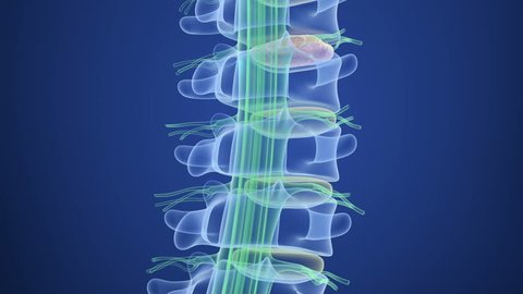 Spinal cord under pressure of bulging disc, X-Ray view. 3D illustration