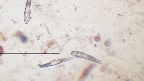 Demodectic Mange mites, Demodex (Demodex canis) seen under microscope at 100 times magnification after doing a skin scrape.