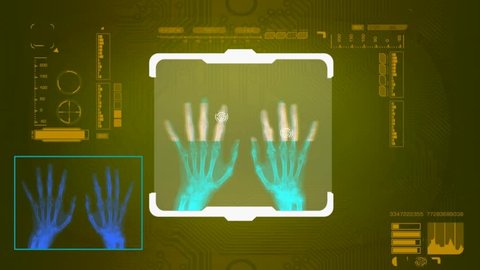 hands scanned by software