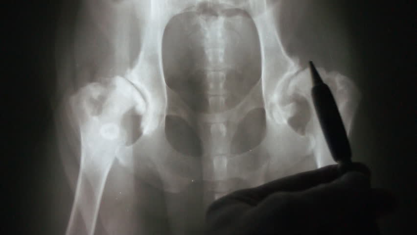 Veterinarian pointing out Severe Hip Dysplasia on a radiograph of a dog.
