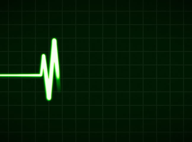 ECG Cardio vascular heart monitor showing heartbeat pulse. NTSC.