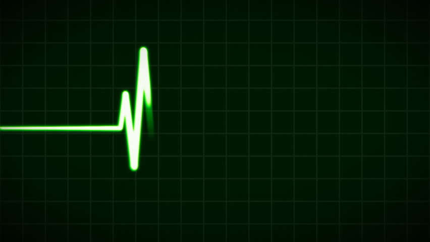 ECG Cardiovascular heart monitor showing heartbeat pulse. HD 1080.