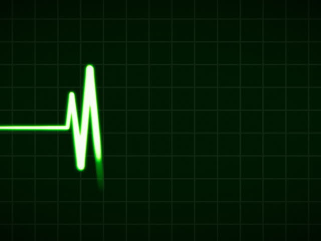 ECG Cardiovascular heart monitor showing heartbeat pulse. PAL.