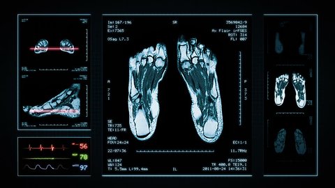Foot MRI Scan. Blue. 3 videos in 1 file. Animation showing top, front, lateral view and ECG display. Each video is loopable. Medical Background.