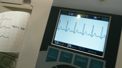 Medical device for monitoring heart activity (ECG), and record the results on a paper tape. Modern cardiograph with display and ability record the schedule of heart on paper