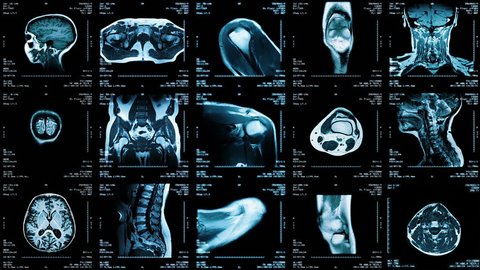 Multiple MRI video wall. Black and white. Loopable. Locked down. 2 videos in 1 file. Composite video showing multiple MRI images including: head, neck, arm, foot, pelvis, etc.