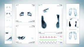Foot MRI Scan. White. 3 videos in 1 file. Animation showing top, front, lateral view and ECG display. Each video is loopable. Medical Background.