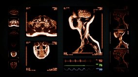Neck MRI Scan. Amber. 3 videos in 1 file. Animation showing top, front, lateral view and ECG display. Each video is loopable. Medical Background.