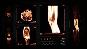 Knee MRI Scan. Amber. 4 videos in 1 file. Animation showing top, front, lateral view and ECG display. Each video is loopable. Medical Background.