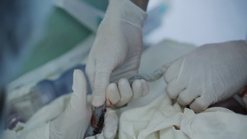 Baby being born via Caesarean Section 