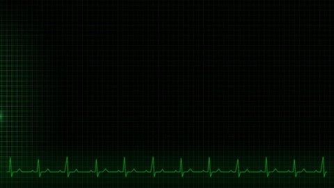 Illustration of a heartbeat impulse line 