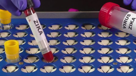 Zika virus concept footage with test tube 
