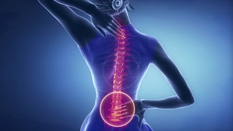 Female backbone pain - spine injury concept in blue