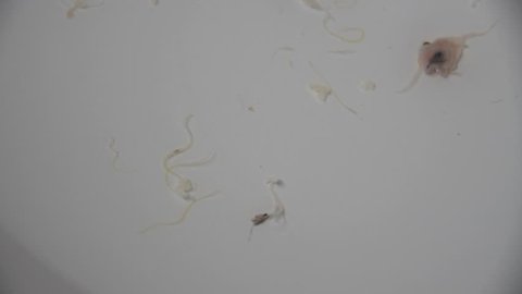 Parasites from sea fish