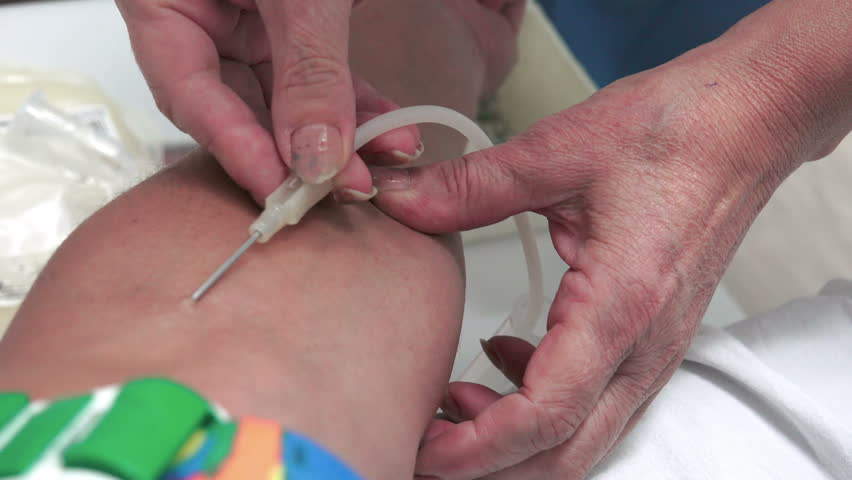 Blood Donation Needle Inserted Into Stock Footage Video 100 Royalty Free 15112768 Shutterstock