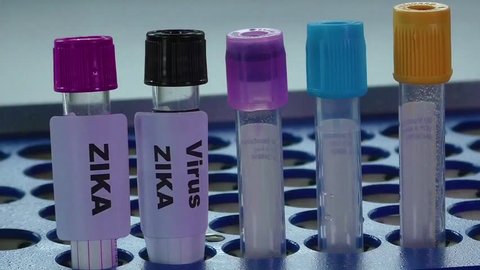 Zika virus concept footage with test tube 