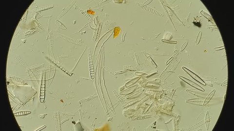 diatom algae cell walls made of silica under microscope, DIC contrast, magnification 1000X