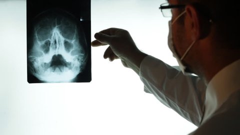 Doctor examining X-ray searching diagnosis. Doctor hand pointing on x-ray image