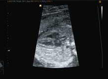 Ultrasonography of heartbeat of the small baby. Video full hd.